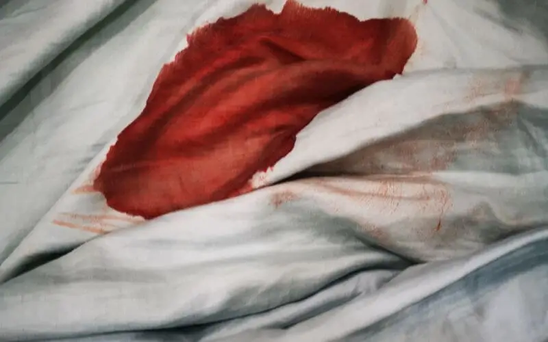 Blood stain on cloth
